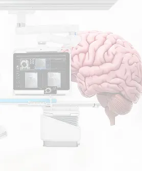 Layanan stroke RS Kemenkes Surabaya