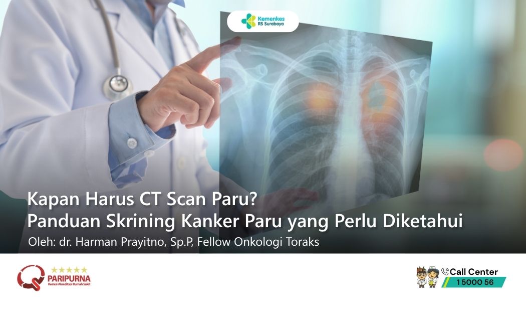 Kapan Harus CT Scan Paru? Panduan Skrining Kanker Paru yang Perlu Diketahui