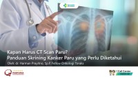 Kapan Harus CT Scan Paru? Panduan Skrining Kanker Paru yang Perlu Diketahui