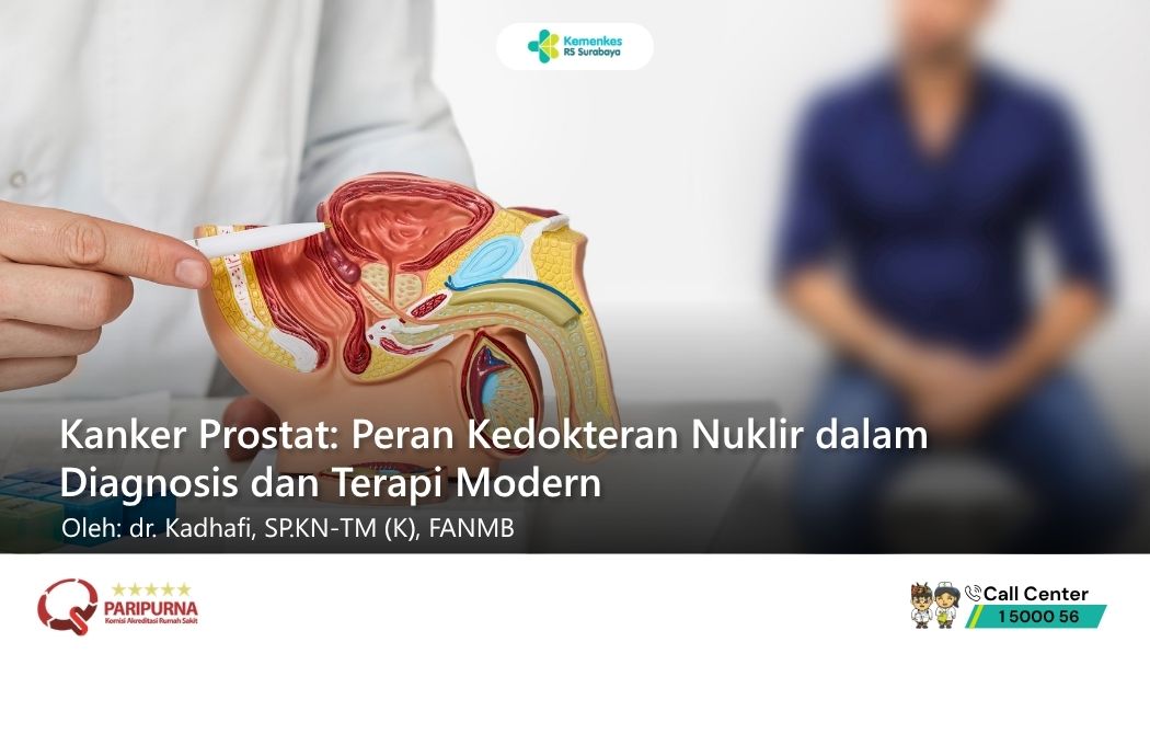 Kanker Prostat dan Kedokteran Nuklir: Harapan Baru Deteksi Dini dan Terapi Tepat Sasaran