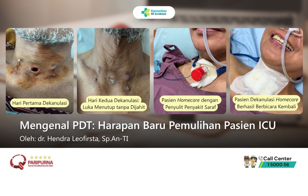 Mengenal PDT: Harapan Baru Pemulihan Pasien ICU