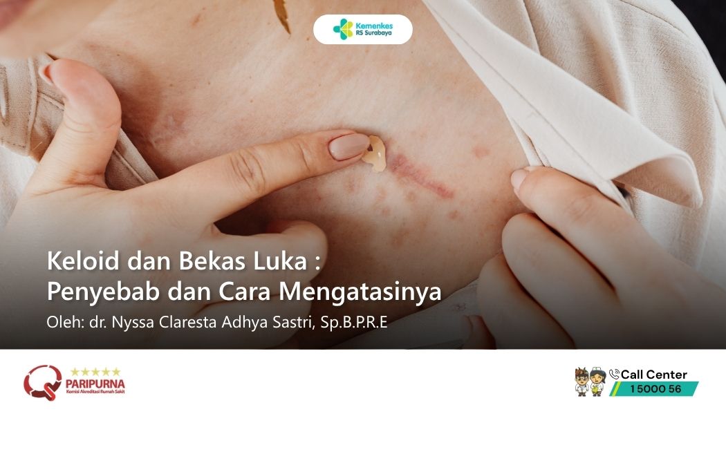 Keloid dan Bekas Luka : Penyebab dan Cara Mengatasinya