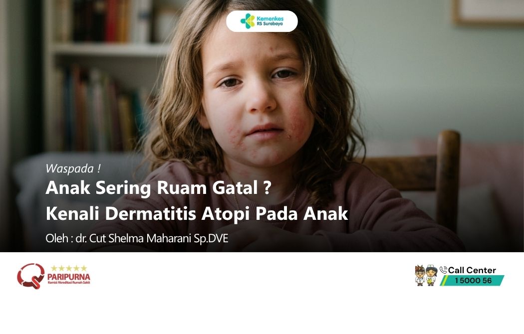 Anak Sering Ruam Gatal? Kenali Dermatitis Atopi!