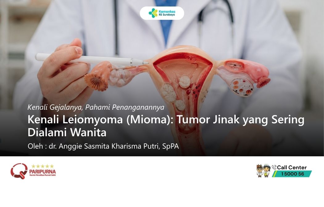 Kenali Leiomyoma (Mioma): Tumor Jinak yang Sering Dialami Wanita