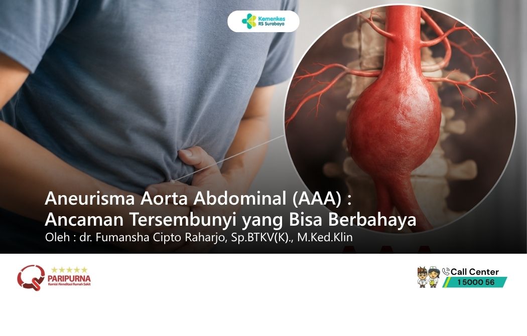 Aneurisma Aorta Abdominal (AAA): Ancaman Tersembunyi yang Bisa Berbahaya 