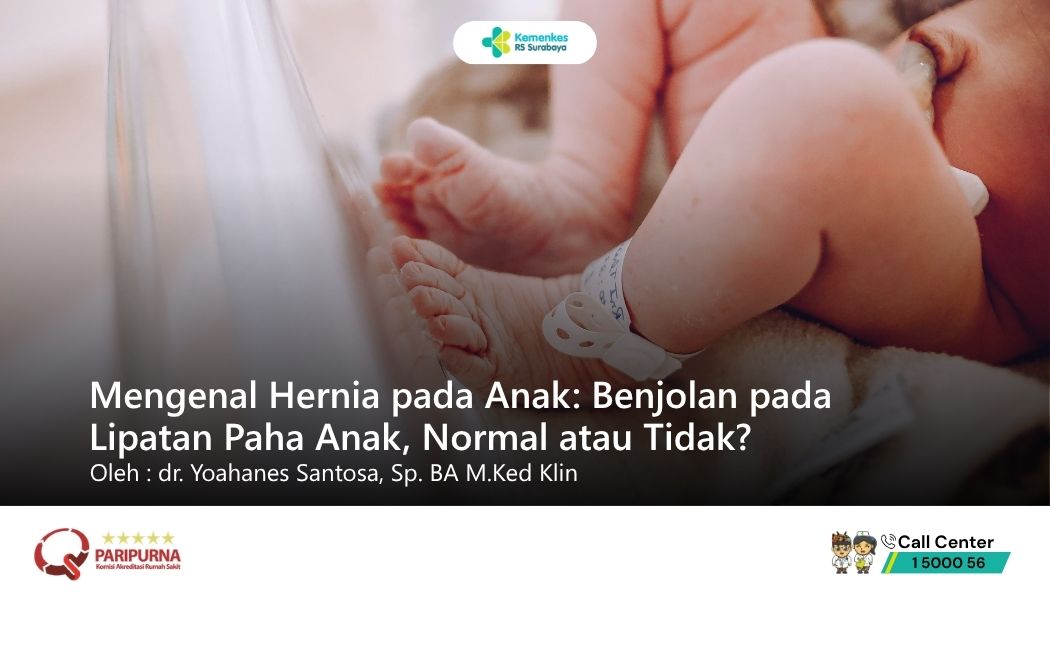 Mengenal Hernia pada Anak: Benjolan pada Lipatan Paha Anak, Normal atau Tidak?