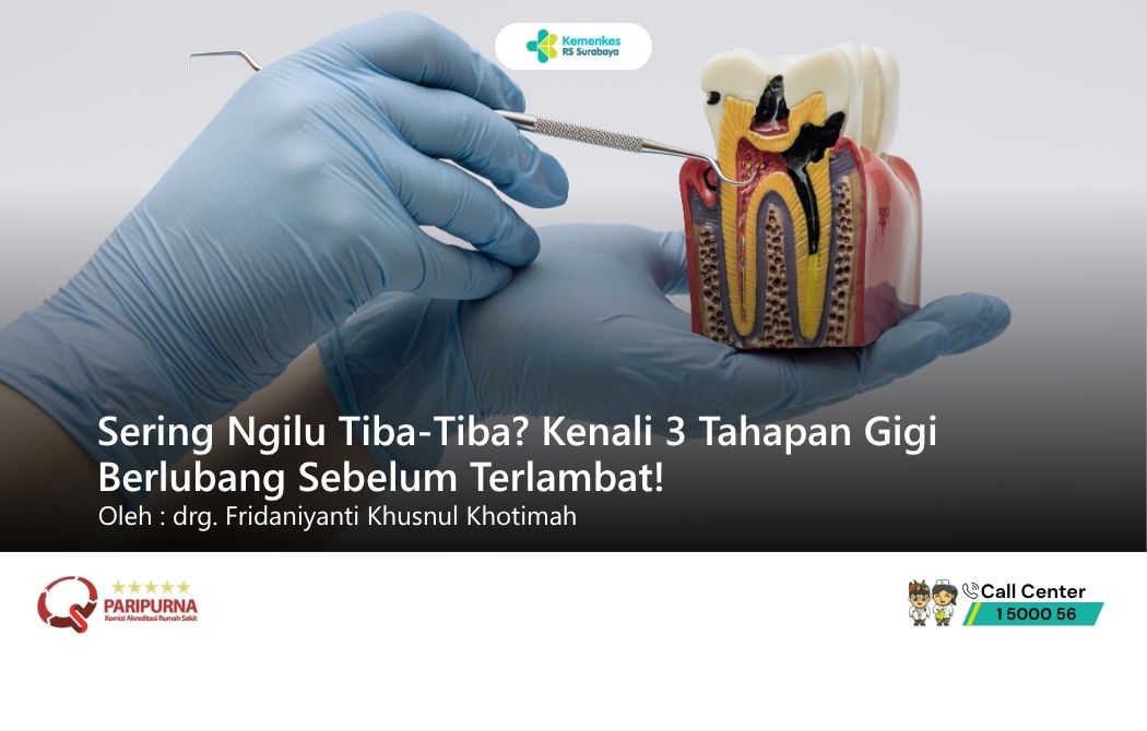 Sering Ngilu Tiba-Tiba? Kenali 3 Tahapan Gigi Berlubang Sebelum Terlambat!