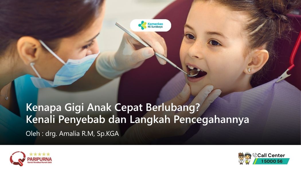 Kenapa Gigi Anak Cepat Berlubang? Kenali Penyebab dan Langkah Pencegahannya 