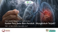 Kanker Paru pada Non-Perokok: Mungkinkah terjadi?