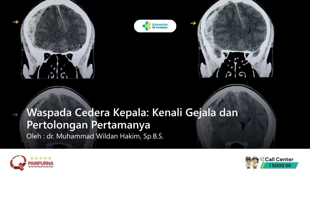 Waspada Cedera Kepala: Kenali Gejala dan Pertolongan Pertamanya