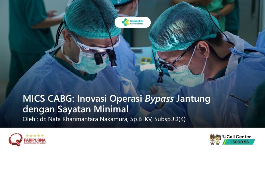 MICS CABG: Inovasi Operasi Bypass Jantung dengan Sayatan Minimal