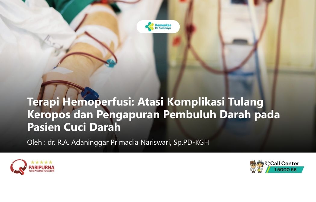 Terapi Hemoperfusi: Atasi Komplikasi Tulang Keropos dan Pengapuran Pembuluh Darah pada Pasien Cuci Darah