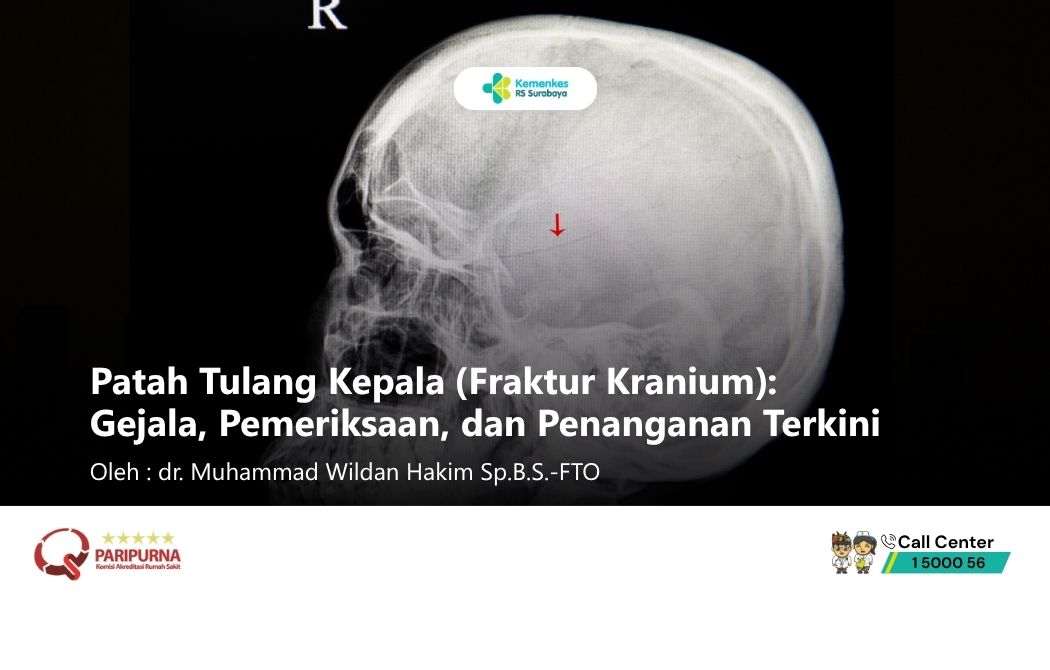 Patah Tulang Kepala (Fraktur Kranium): Gejala, Pemeriksaan, dan Penanganan Terkini