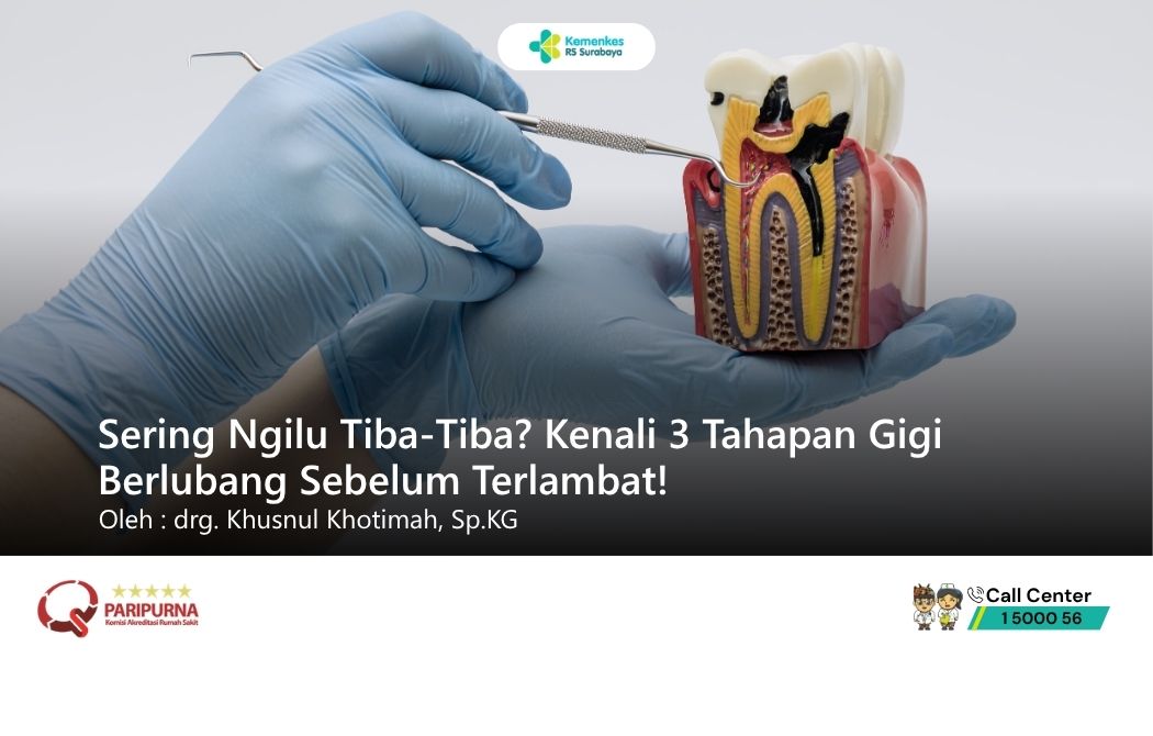 Sering Ngilu Tiba-Tiba? Kenali 3 Tahapan Gigi Berlubang Sebelum Terlambat!