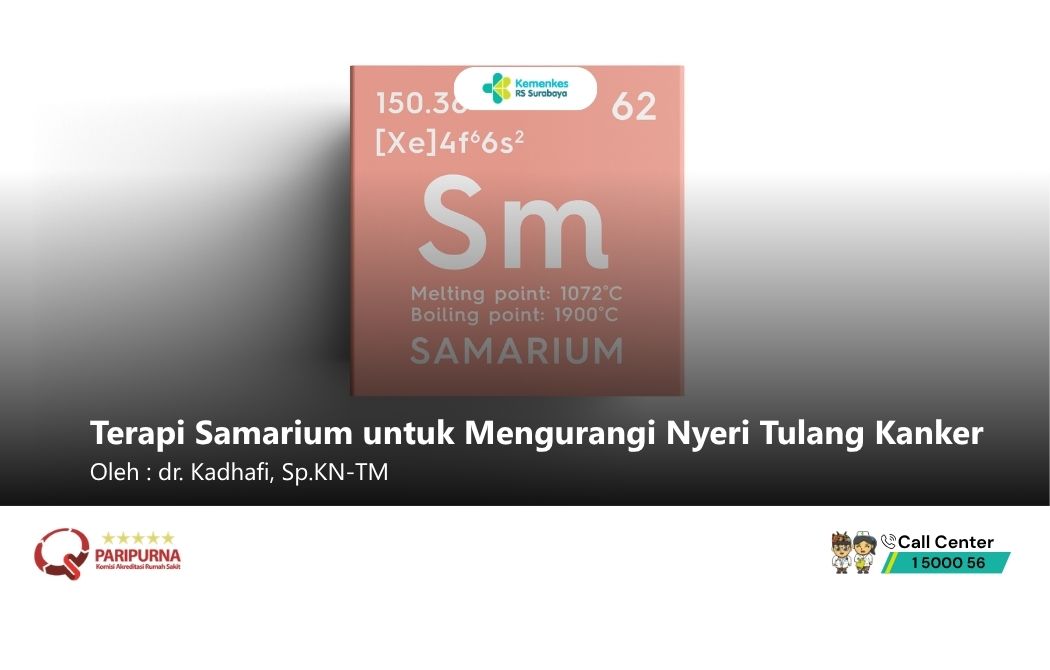 Terapi Samarium untuk Mengurangi Nyeri Tulang Kanker