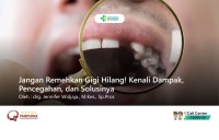 Jangan Remehkan Gigi Hilang! Kenali Dampak, Pencegahan, dan Solusinya