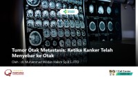 Tumor Otak Metastasis: Ketika Kanker Telah Menyebar ke Otak