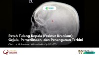 Patah Tulang Kepala (Fraktur Kranium): Gejala, Pemeriksaan, dan Penanganan Terkini