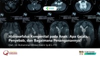 Hidrosefalus Kongenital pada Anak: Apa Gejala, Penyebab, dan Penanganannya?