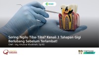 Sering Ngilu Tiba-Tiba? Kenali 3 Tahapan Gigi Berlubang Sebelum Terlambat!